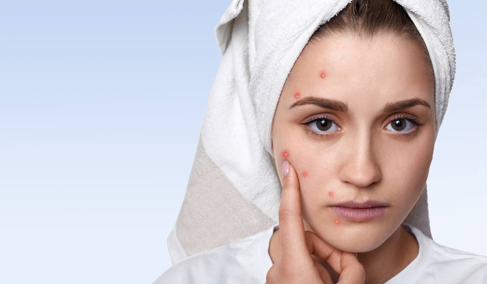 Boutons, verrues, grains de beauté : comment retrouver une peau nette sans passer par la case dermatologue ?